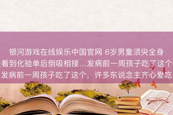 银河游戏在线娱乐中国官网 6岁男童须臾全身大片青斑、血肿！大夫看到化验单后倒吸相接…发病前一周孩子吃了这个，许多东说念主齐心爱吃