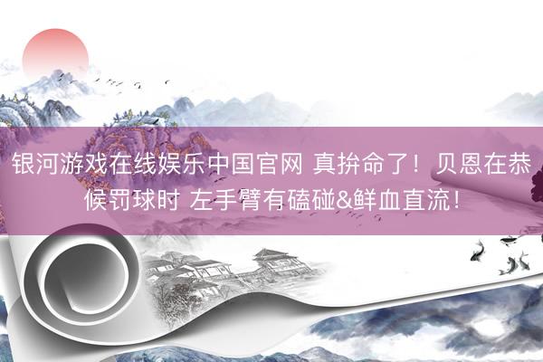 银河游戏在线娱乐中国官网 真拚命了！贝恩在恭候罚球时 左手臂有磕碰&鲜血直流！